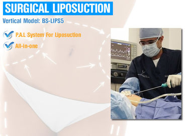 목/Chin/팔 지방 제거를 위한 기계를 체중을 줄이는 1개의 성형 수술 Lipo에서 모두