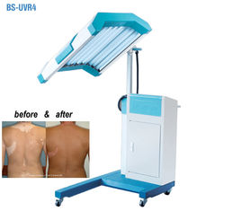 Phototherapy 처리 UVB 빛 치료 기계, UVB 좁은 밴드 가벼운 치료